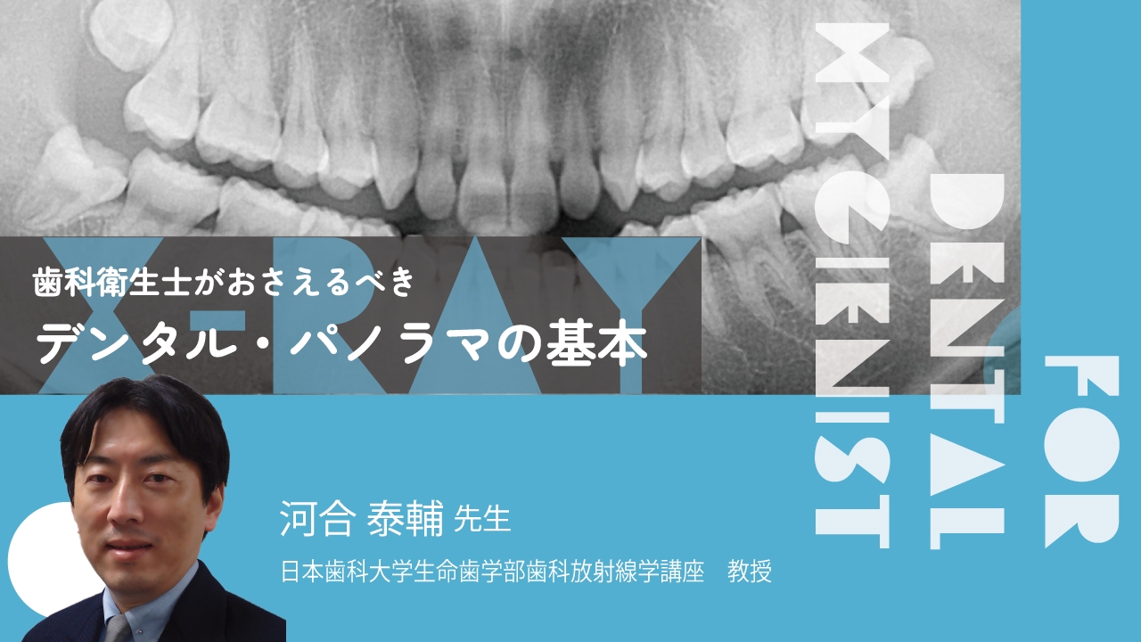 歯科衛生士がおさえるべきデンタル・パノラマの基本 | WHITE CROSS